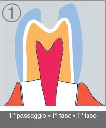 K1