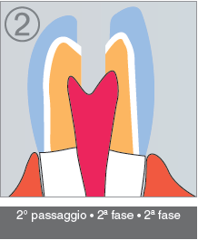 K2